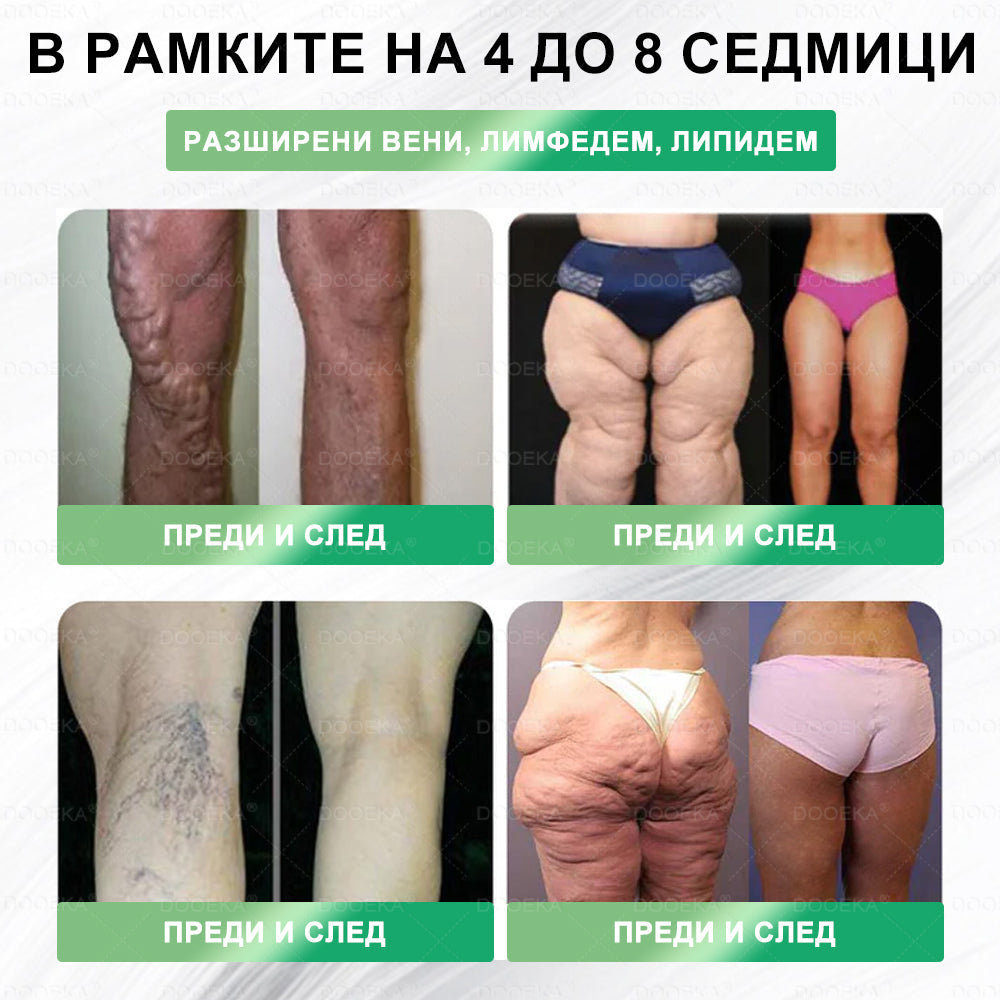 DOOEKA® GLP-1 8-в-1 Фит & Витал орален разтвор | Само веднъж на ден.Видими резултати само за 7 дни. | За затлъстяване и контрол на теглото, сърдечно-съдово здраве, диабет, сънна апнея, здраве на червата, проблеми със ставите и други.